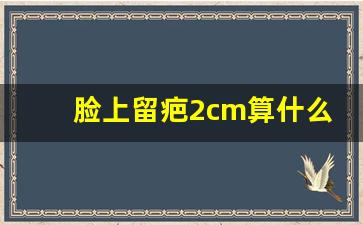 脸上留疤2cm算什么伤,面部留下疤痕一次性赔付多少钱